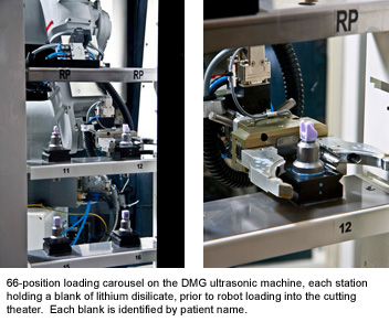 9. 66  - 位于DMG超声波机上的位置装载转盘，每个站持有锂硅酸盐的空白，在机器人装入切割剧院之前。每个空白由患者姓名识别。