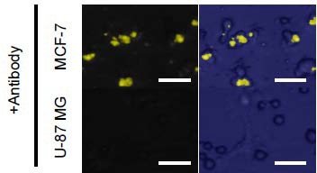 人乳腺癌MCF-7和人胶质母细胞瘤U87MG细胞的抗体染色