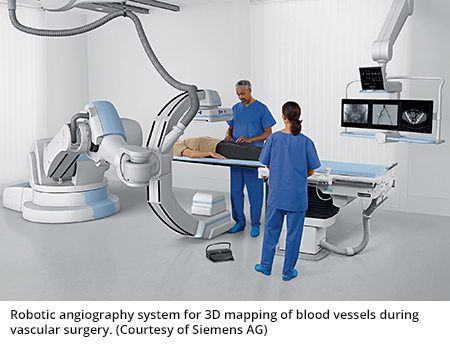 血管手术中血管3D映射的机器人血管造影系统。（由西门子AG提供）