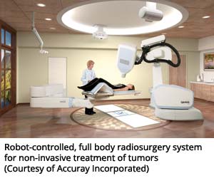 机器人控制，全身放射外科系统，用于肿瘤的非侵入性治疗（由Cleashate Contanated提供）